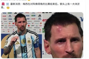一场苦战！梅西赛后额头上有一大块淤青